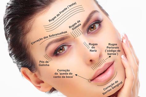 http://bo.orthoclinic.pt/fileuploads/Serviços/Estética e Reabilitação Oral/_toxina-botulinica.jpg